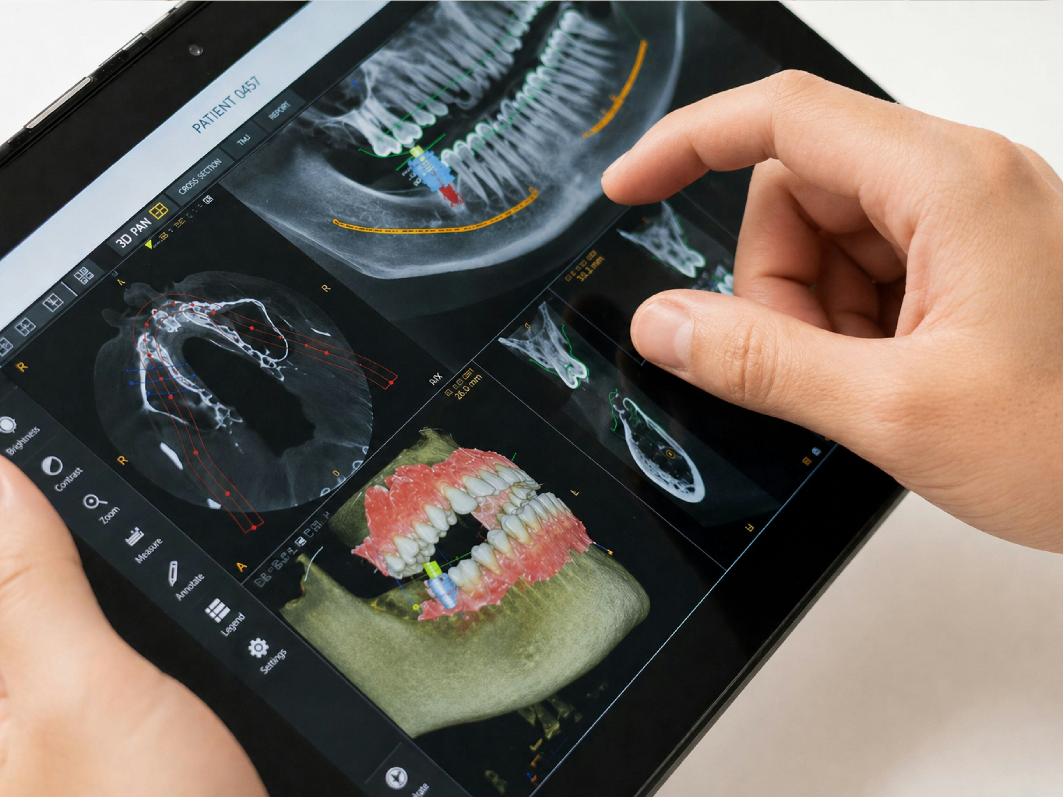 Digitale diagnostische beoordeling in een tandheelkundige kliniek in Tirana